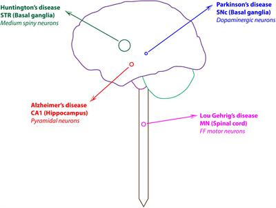 Neurodegenerative Diseases – Is Metabolic Deficiency the Root Cause?